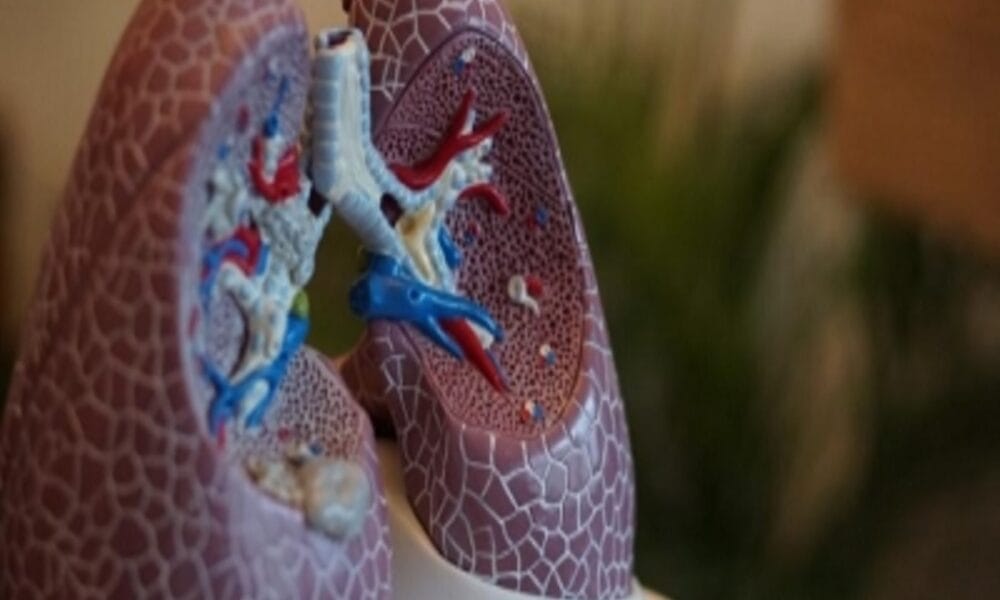 Transplanting patients own lung cells shows promise for people with COPD