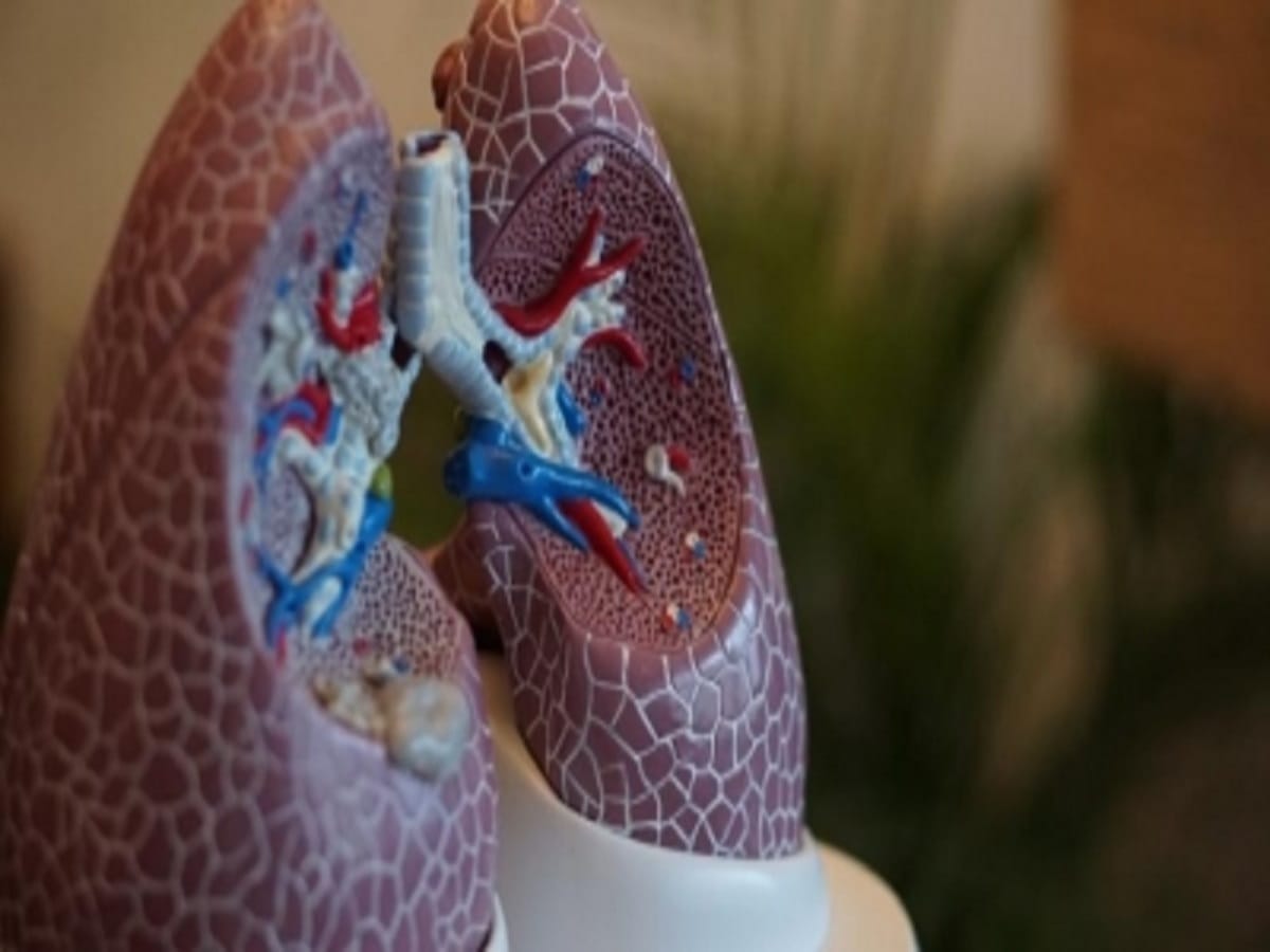 Transplanting patients own lung cells shows promise for people with COPD
