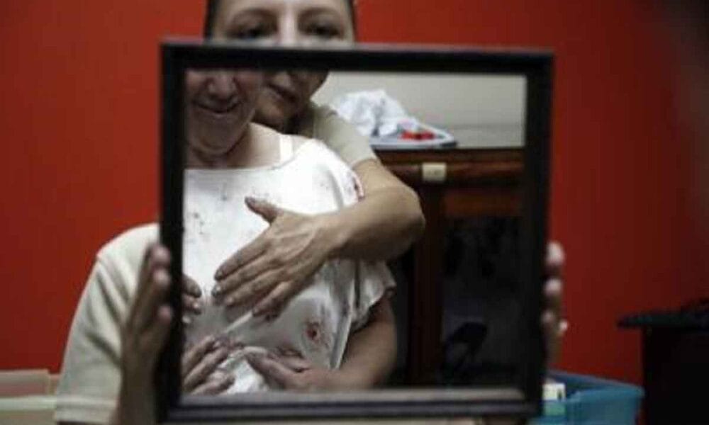 Chemotherapy in childhood may raise breast cancer risk later