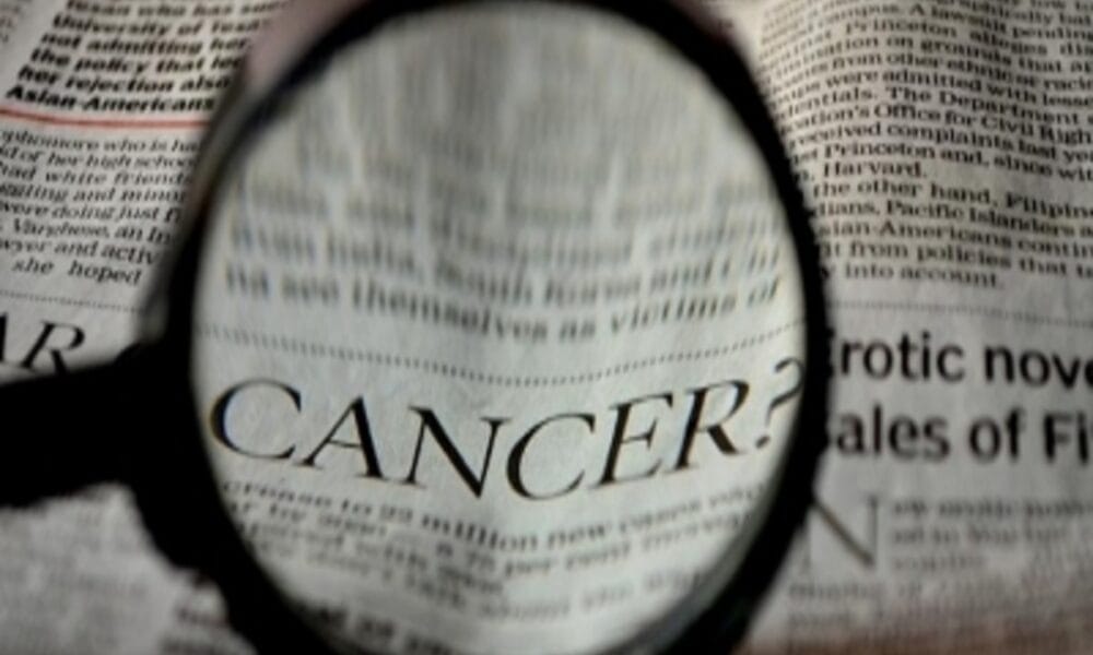 Cancer cases, deaths to rise globally among under 50-s by 2030: Study