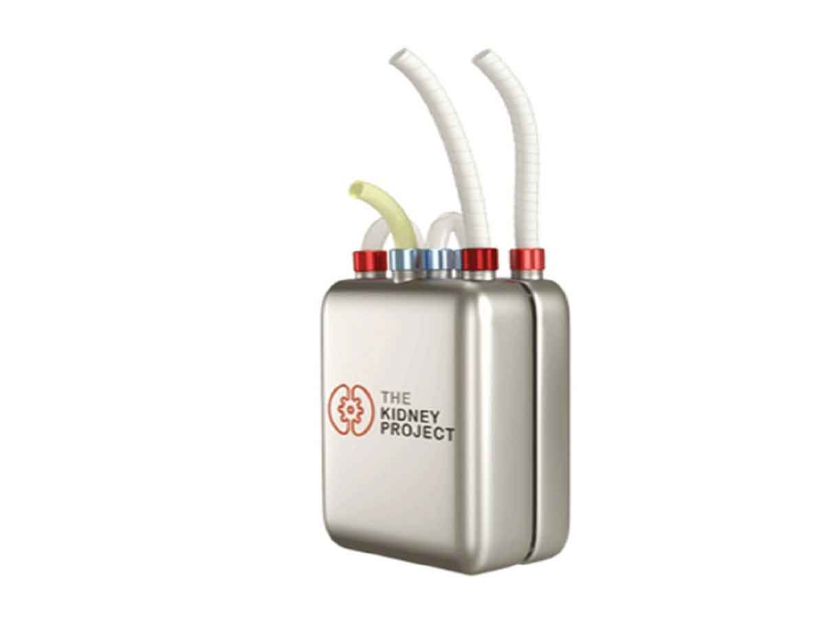New artificial kidney-like device to free patients from dialysis