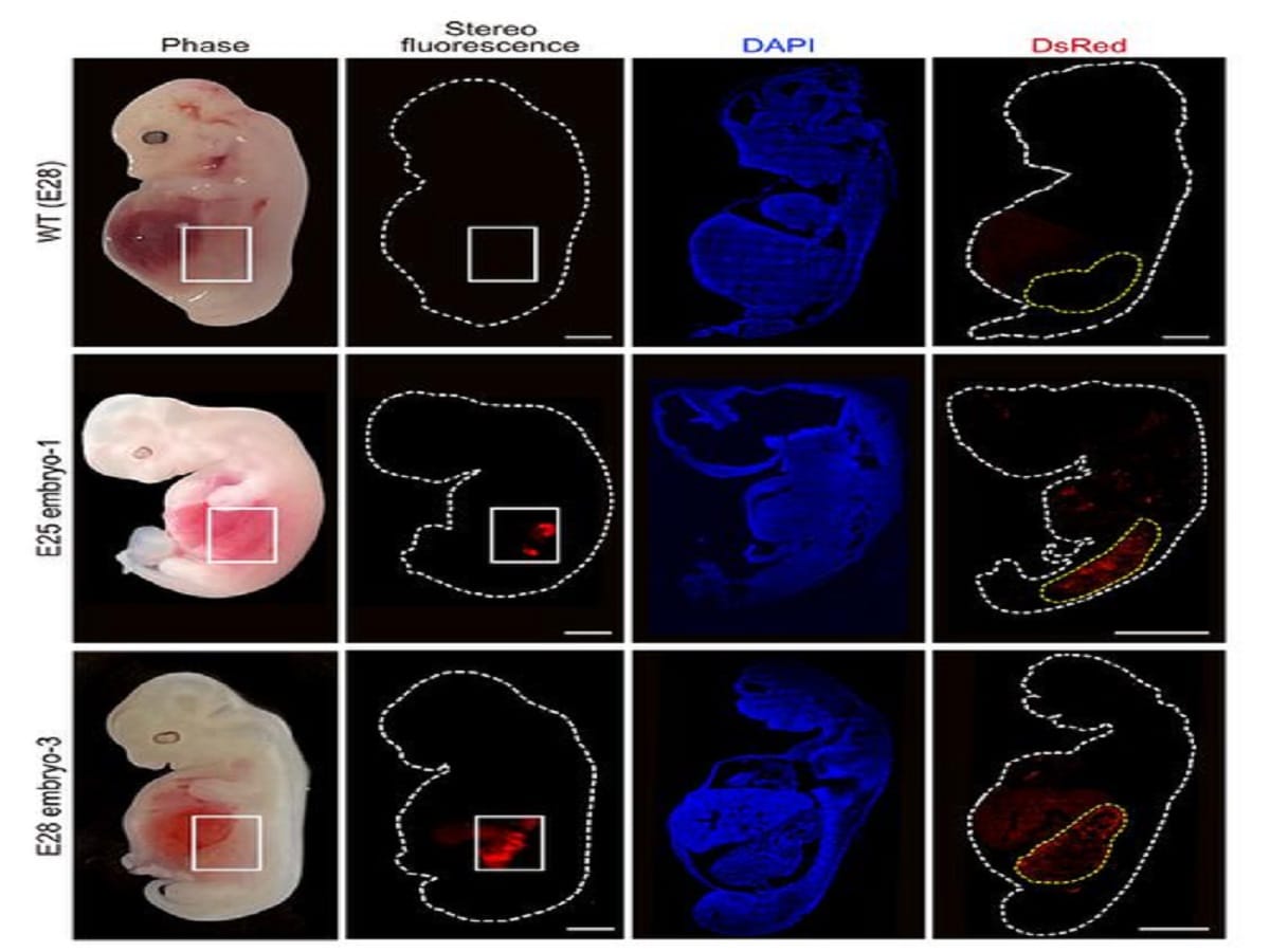 World’s first human-like kidneys in grown pigs