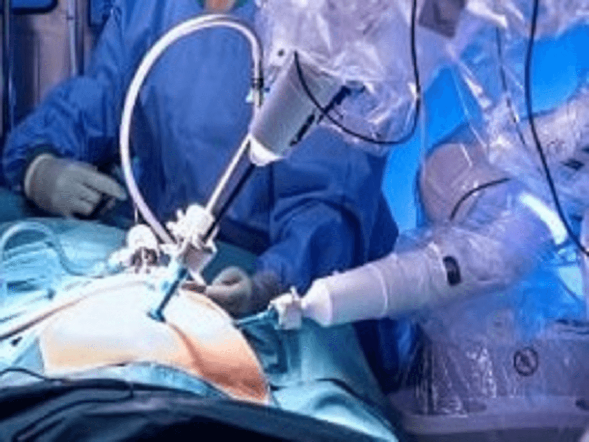 Study reports first steps toward robotic bladder transplantation in humans