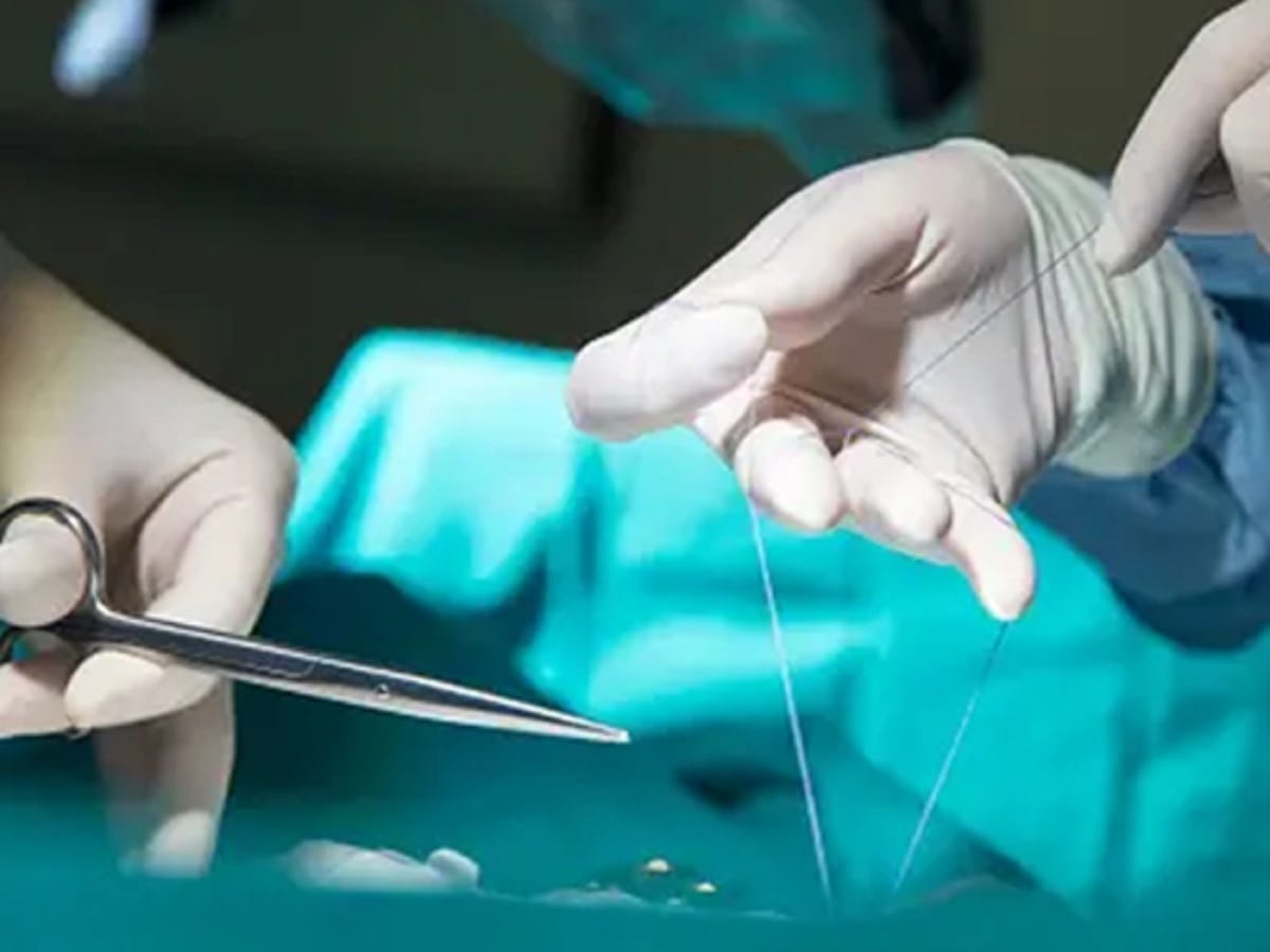 India surgical sutures market to grow to $380 mn in 2030: Report