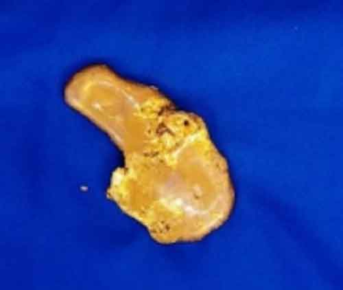 Man held at IGI airport with gold paste worth Rs 98 L
