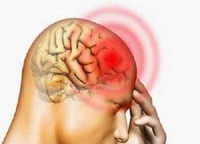 Study predicts increased resurgence in invasive meningitis cases