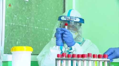 JN.1 Covid variant cases on the rise, experts advise not to panic