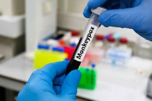 Mpox: WHO reports 906 new cases from 26 countries in November