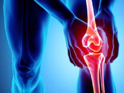 Epilepsy drug may help slow joint degeneration in osteoarthritis