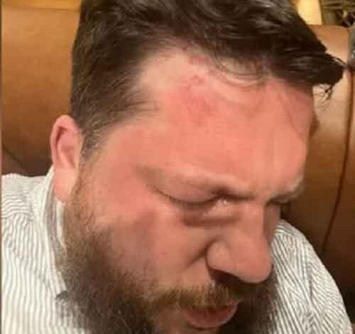 Putin critic Navalny’s ally Leonid Volkov attacked in Lithuania