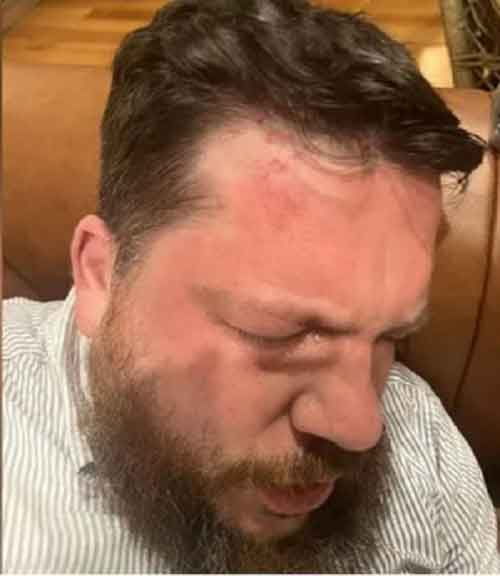 Putin critic Navalny’s ally Leonid Volkov attacked in Lithuania