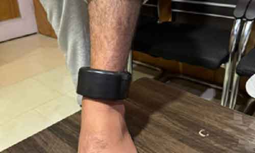 J&K Police starts using GPS tracker anklets to monitor criminals on bail