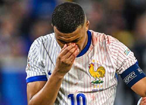 Euro 2024: France’s Mbappe may miss remaining Group Stage games following nose injury: Report