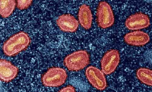 ‘New Mpox Clade 1b worrying, can spread via physical contact, raise mortality rate’