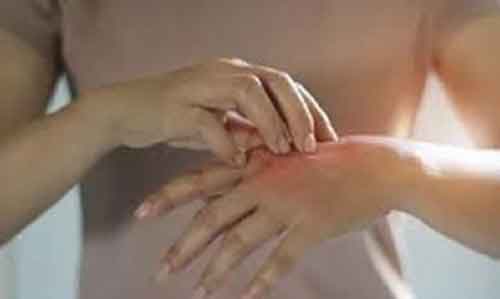 Hand, foot and mouth disease at warning level in Japan