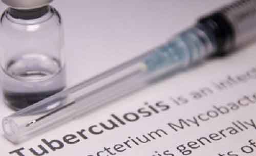 Developing countries in Asia-Pacific still report high TB cases: ADB