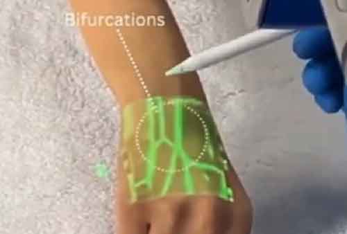 Anand Mahindra shares video of new tech detecting veins using infrared light