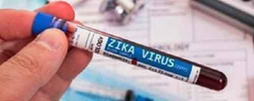 Maternal Zika infection may have long-term effects on babies’ immune system