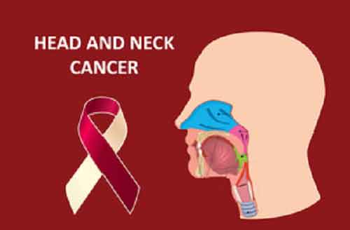 Head and neck cancers on the rise in India, youth at key risk: Experts