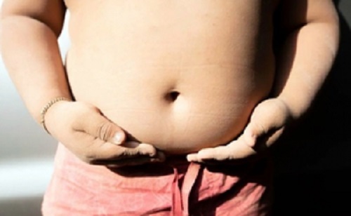 Obese children more likely to develop immune-related diseases: Study