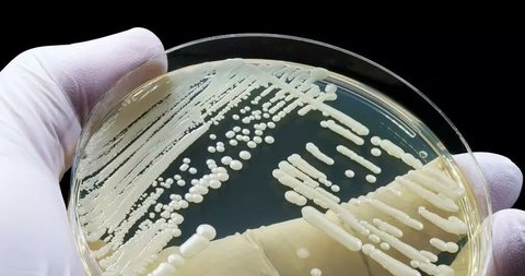 California Faces Threat from Spreading Deadly Fungal Disease