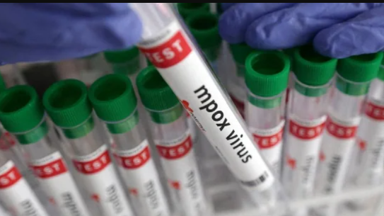 Kenya Reports Rise in Mpox Cases to Nine Amid Increased Disease Prevention Efforts