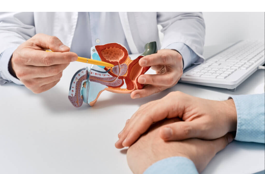 Prostate cancer screening: What you need to know