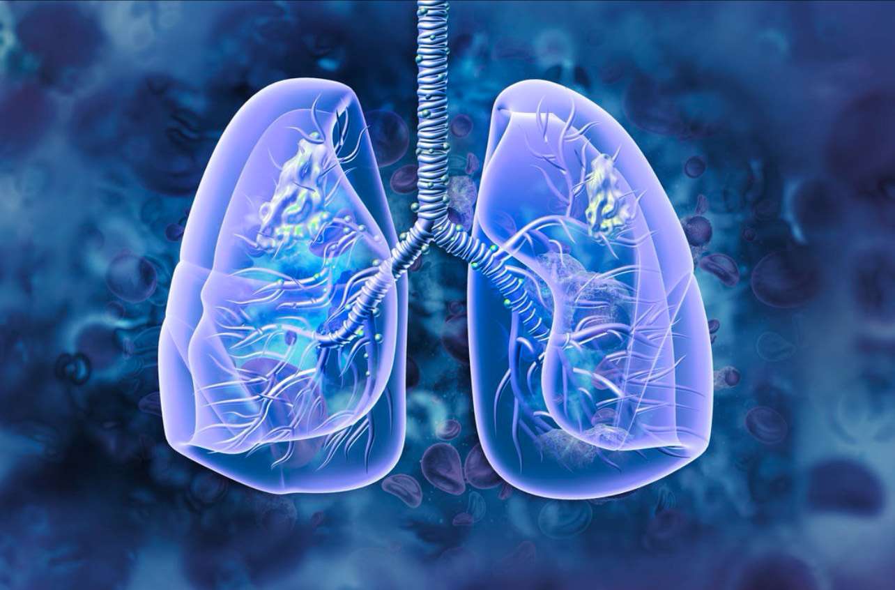 AI-powered lung test revolutionizes COPD diagnosis in GP surgeries