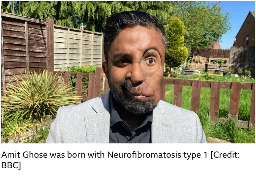 Amit Ghose: From pain to purpose