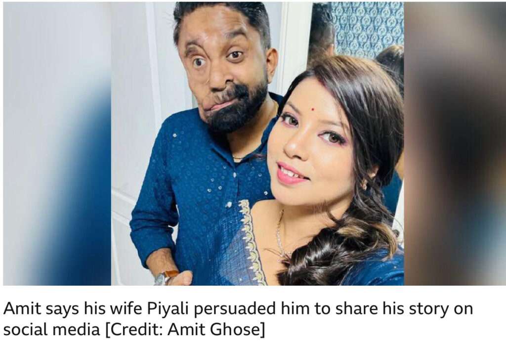 Amit Ghose: From pain to purpose