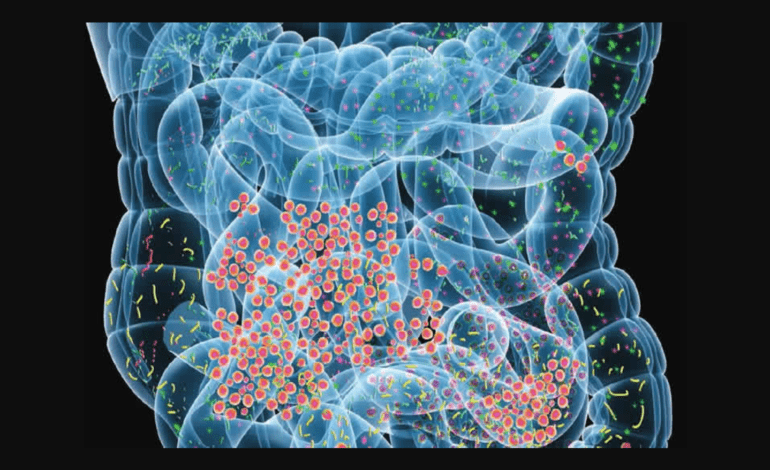 Gut bacteria under the microscope: Breakthrough links microbes to Multiple Sclerosis risk