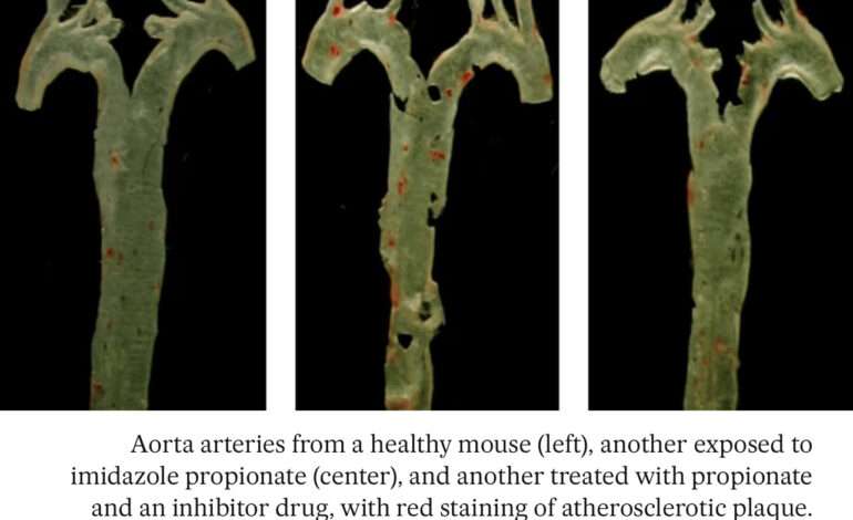 A Gut Reaction: Revolutionary Discovery Links Gut Bacteria Molecule to Heart Disease