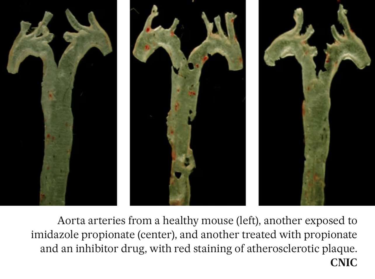A Gut Reaction: Revolutionary Discovery Links Gut Bacteria Molecule to Heart Disease