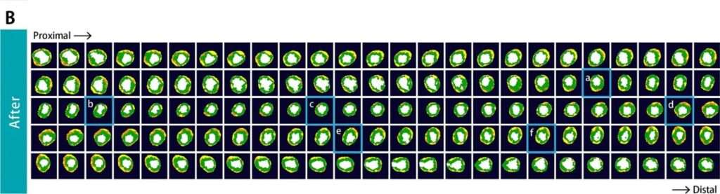 Japanese study shows supplement reversing rare heart disease