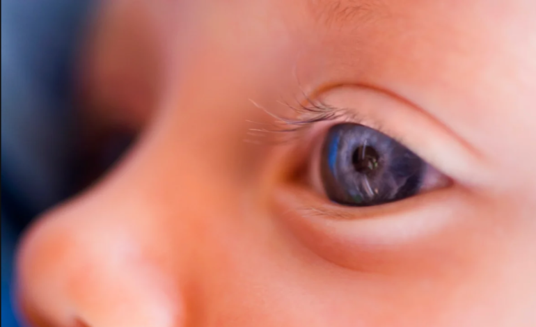 Gene therapy restores vision in children born with rare inherited blindness: Breakthrough treatment offers new hope for genetic eye disorders