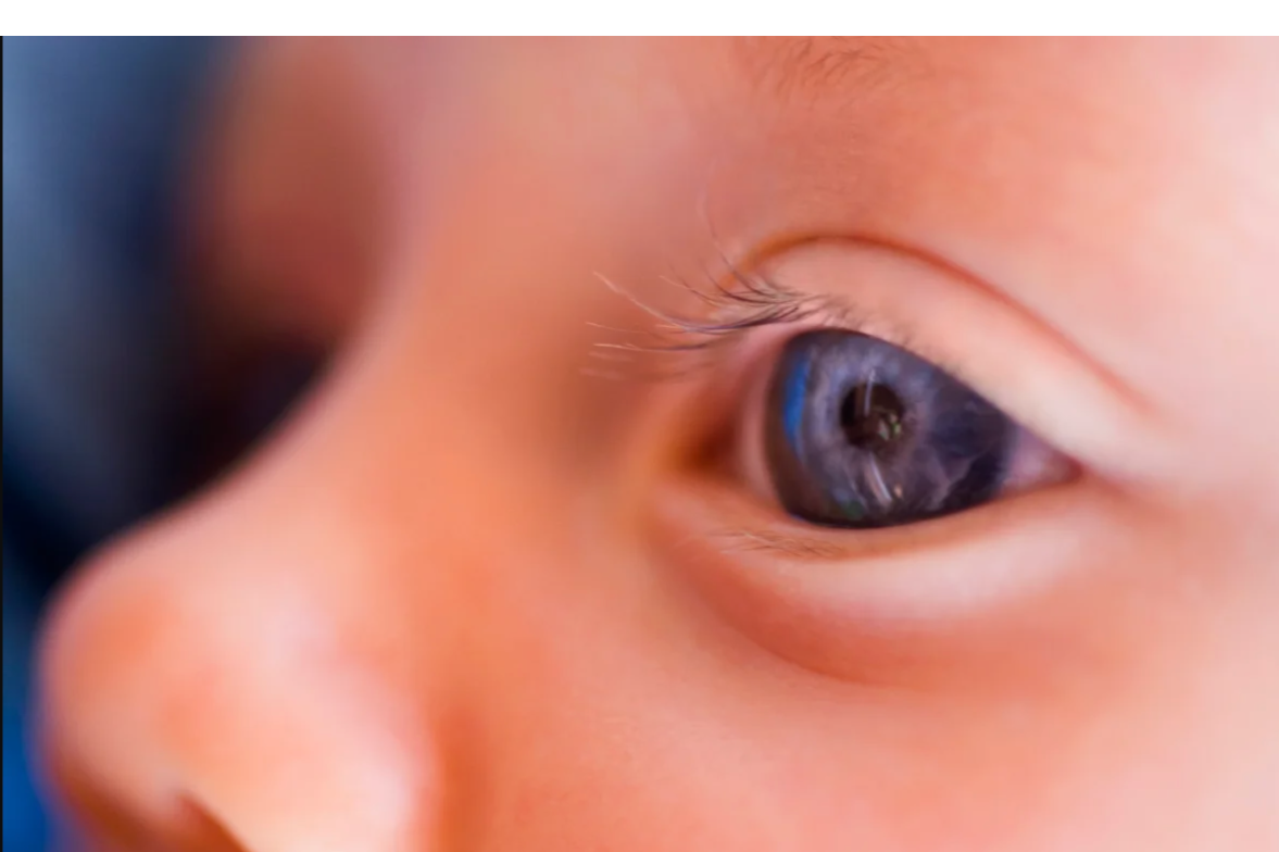Gene therapy restores vision in children born with rare inherited blindness: Breakthrough treatment offers new hope for genetic eye disorders