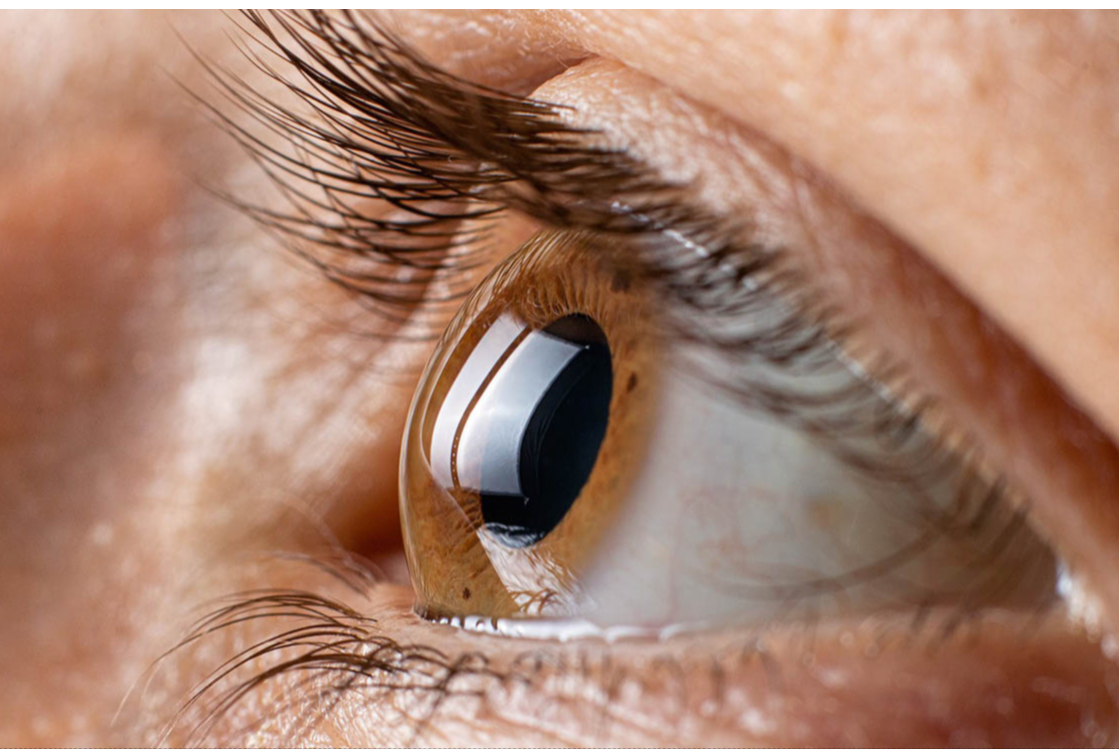 Protect your vision, protect your life: Part 3