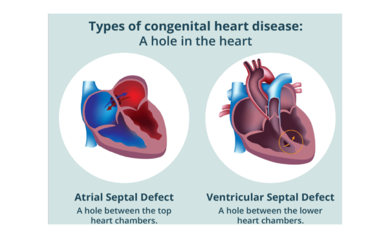 HEALTHY HEART, HEALTHY LIFE SERIES