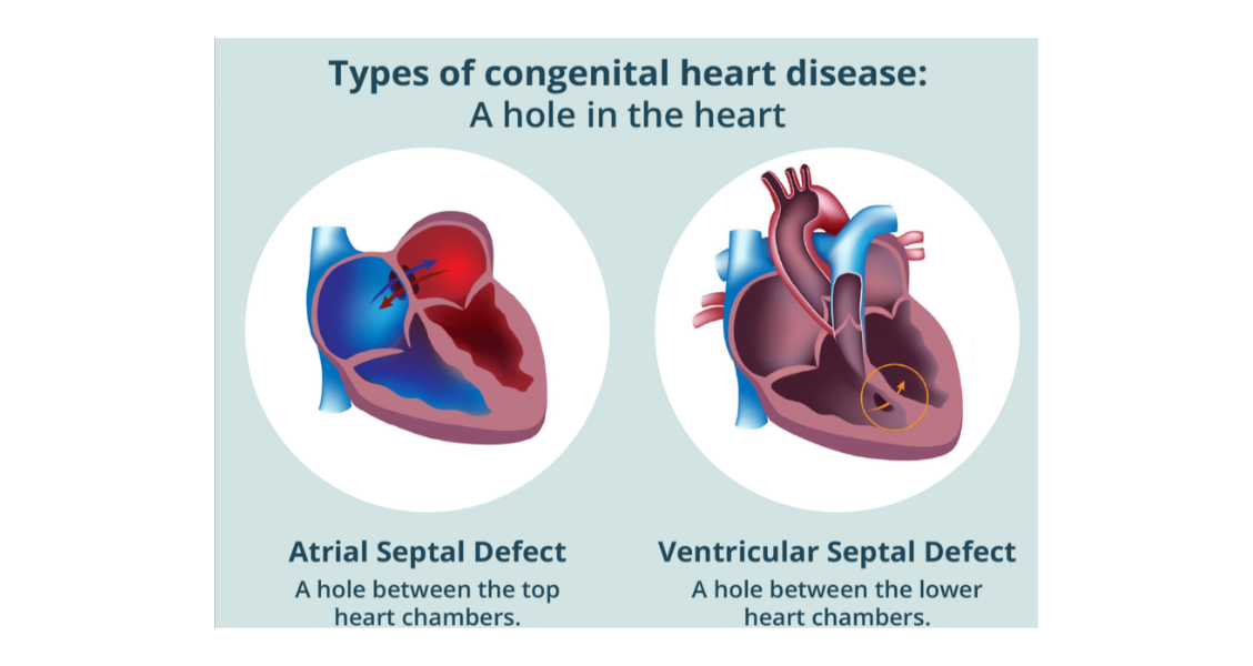 HEALTHY HEART, HEALTHY LIFE SERIES