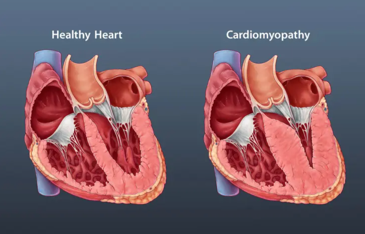 Healthy Heart, Healthy Life