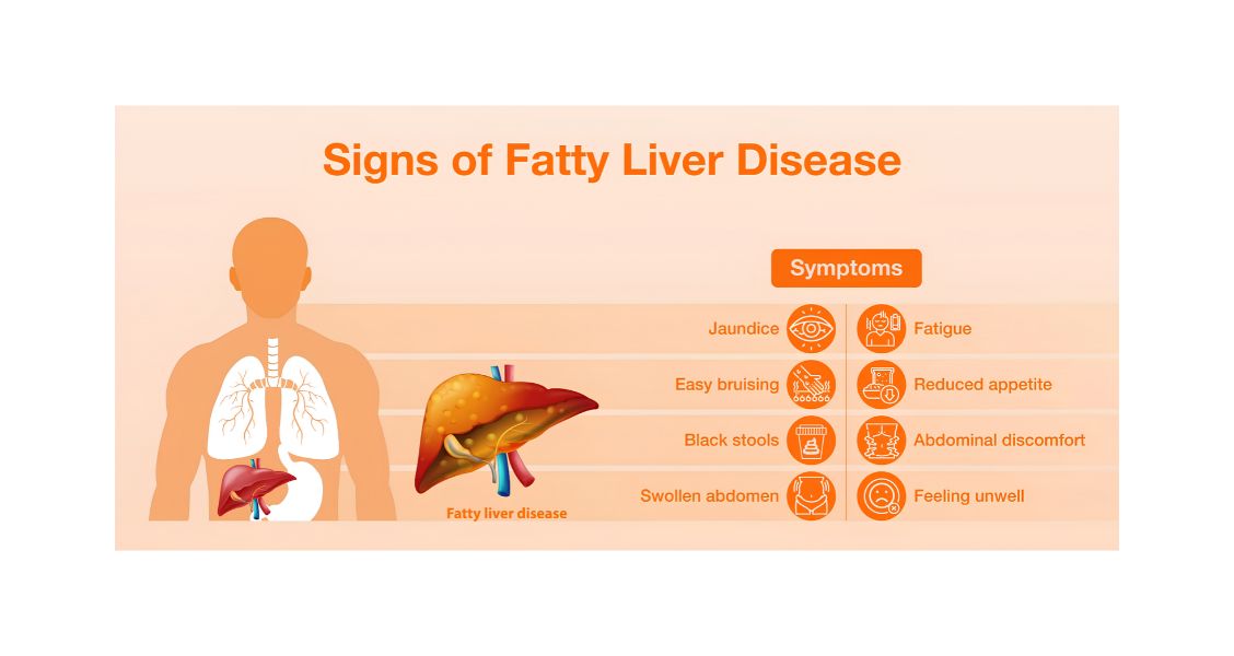 Part 6 – Your liver and your health: Understanding fatty liver disease